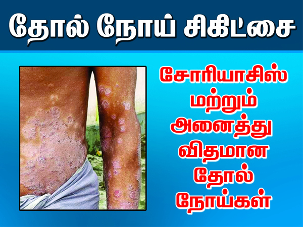 Siddha Medicine